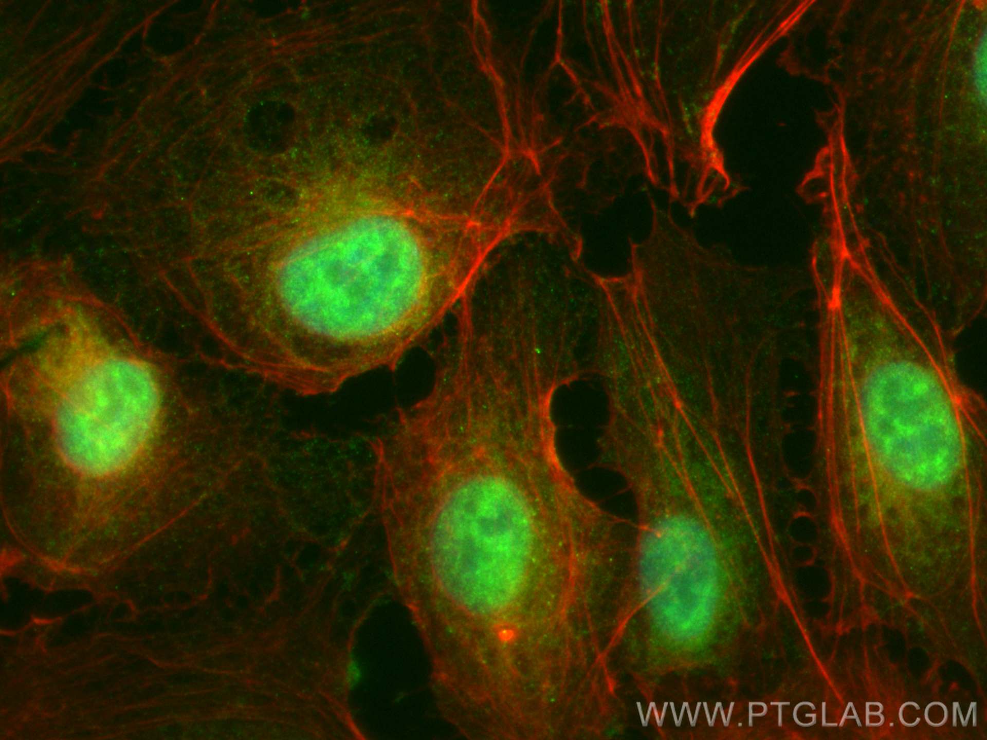 IF Staining of HUVEC using CL488-28613