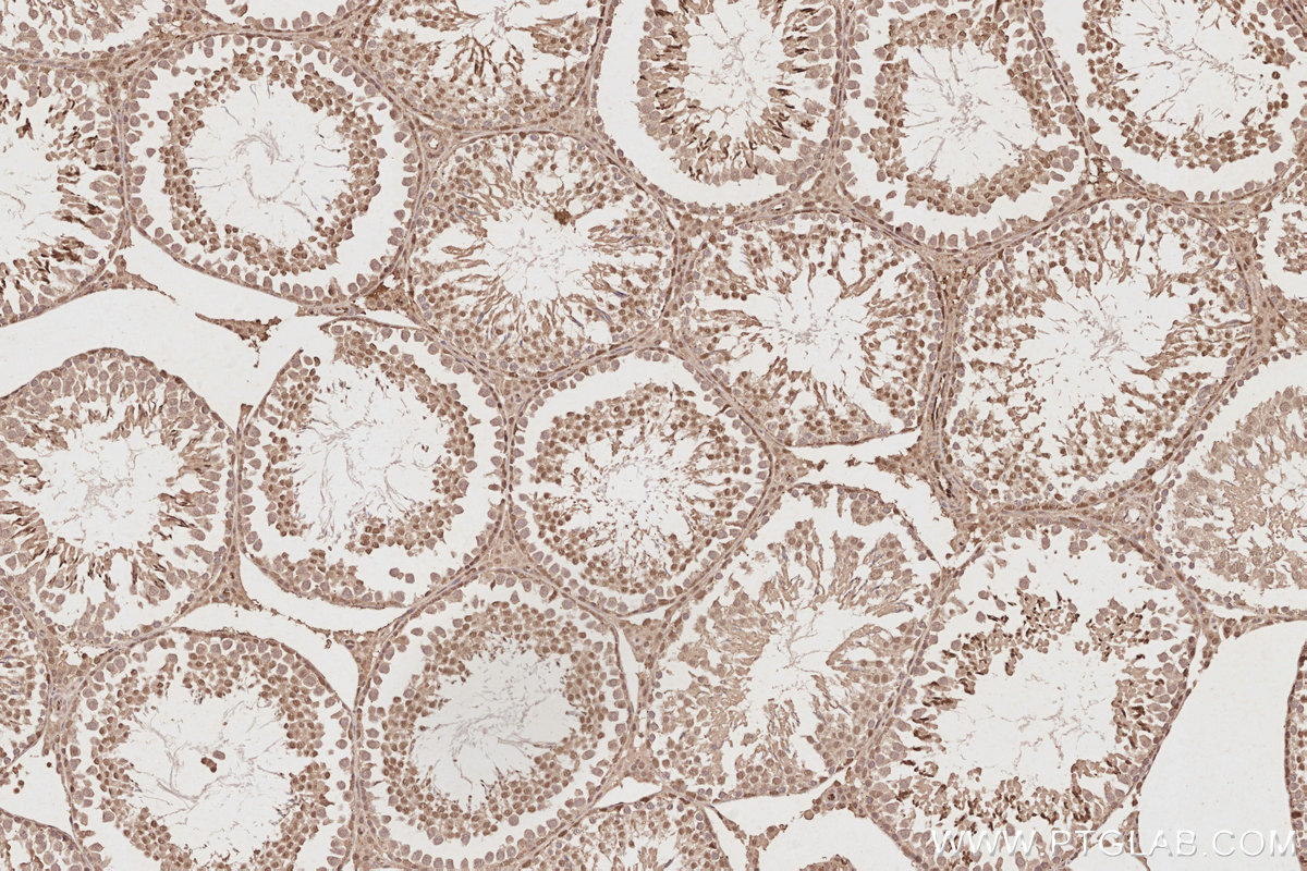 IHC staining of rat testis using 13761-1-AP IHC staining of rat testis using 13761-1-AP