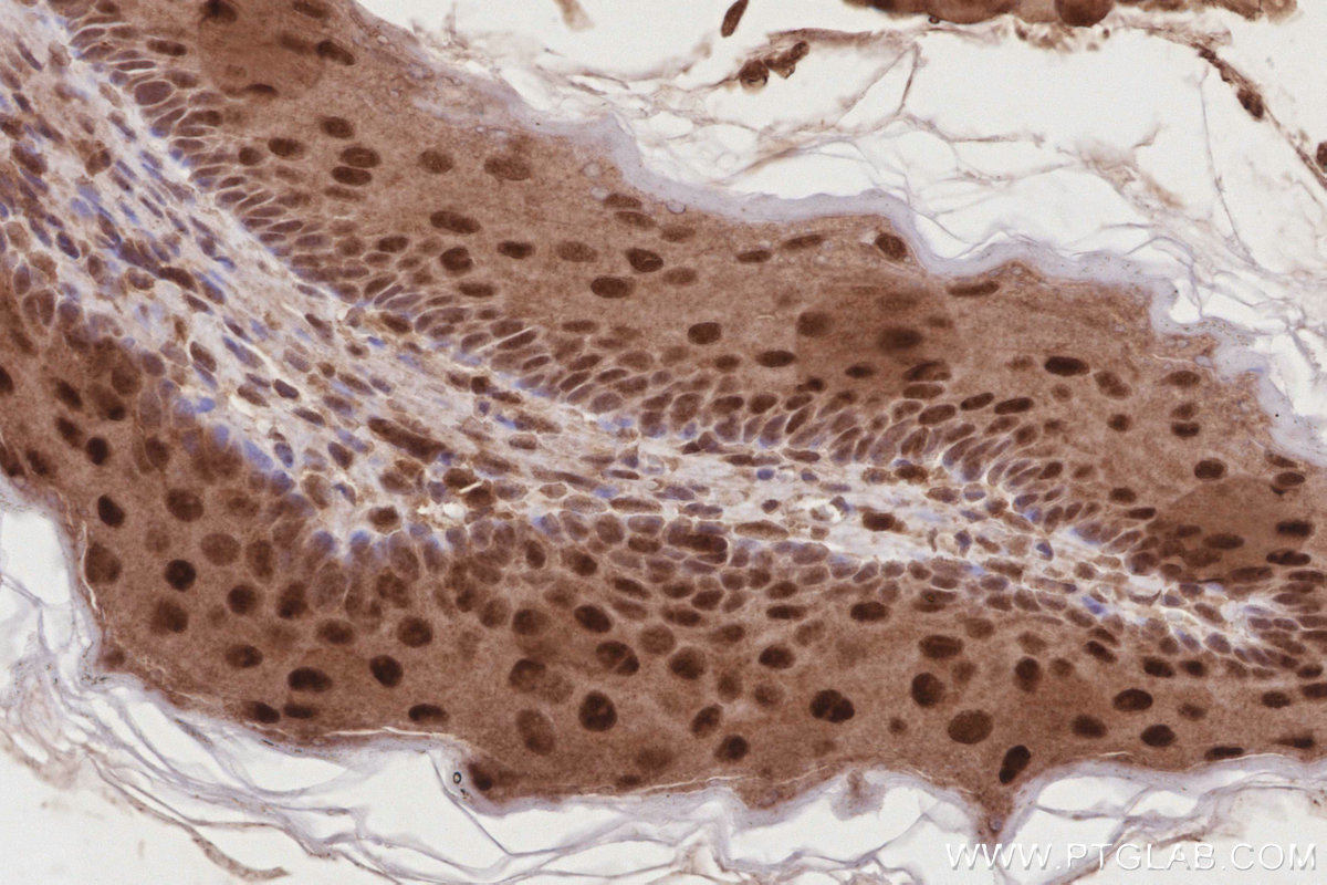 IHC staining of mouse stomach using 13761-1-AP IHC staining of mouse stomach using 13761-1-AP