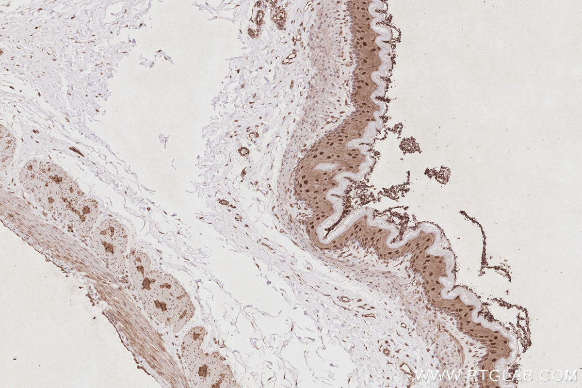 IHC staining of rat stomach using 13761-1-AP IHC staining of rat stomach using 13761-1-AP