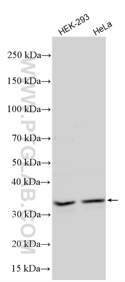 Various lysates were subjected to SDS PAGE followed by western blot with 10964-2-AP (CDC34 antibody) at dilution of 1:600 incubated at room temperature for 1.5 hours. WB analysis using 10964-2-AP