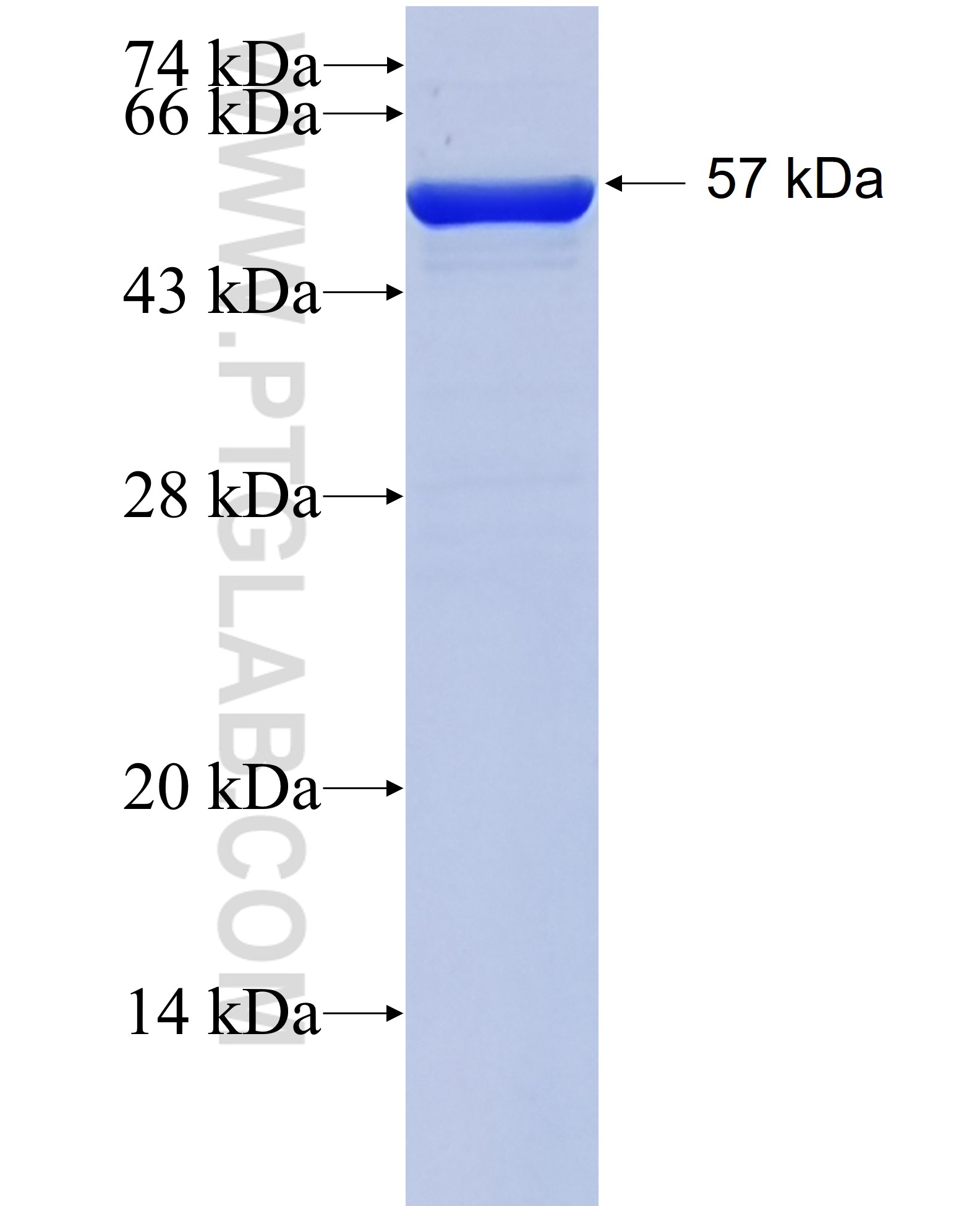 CDC34 fusion protein Ag1438 SDS-PAGE