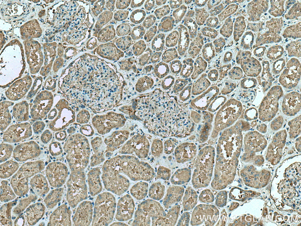 IHC staining of human kidney using 16293-1-AP