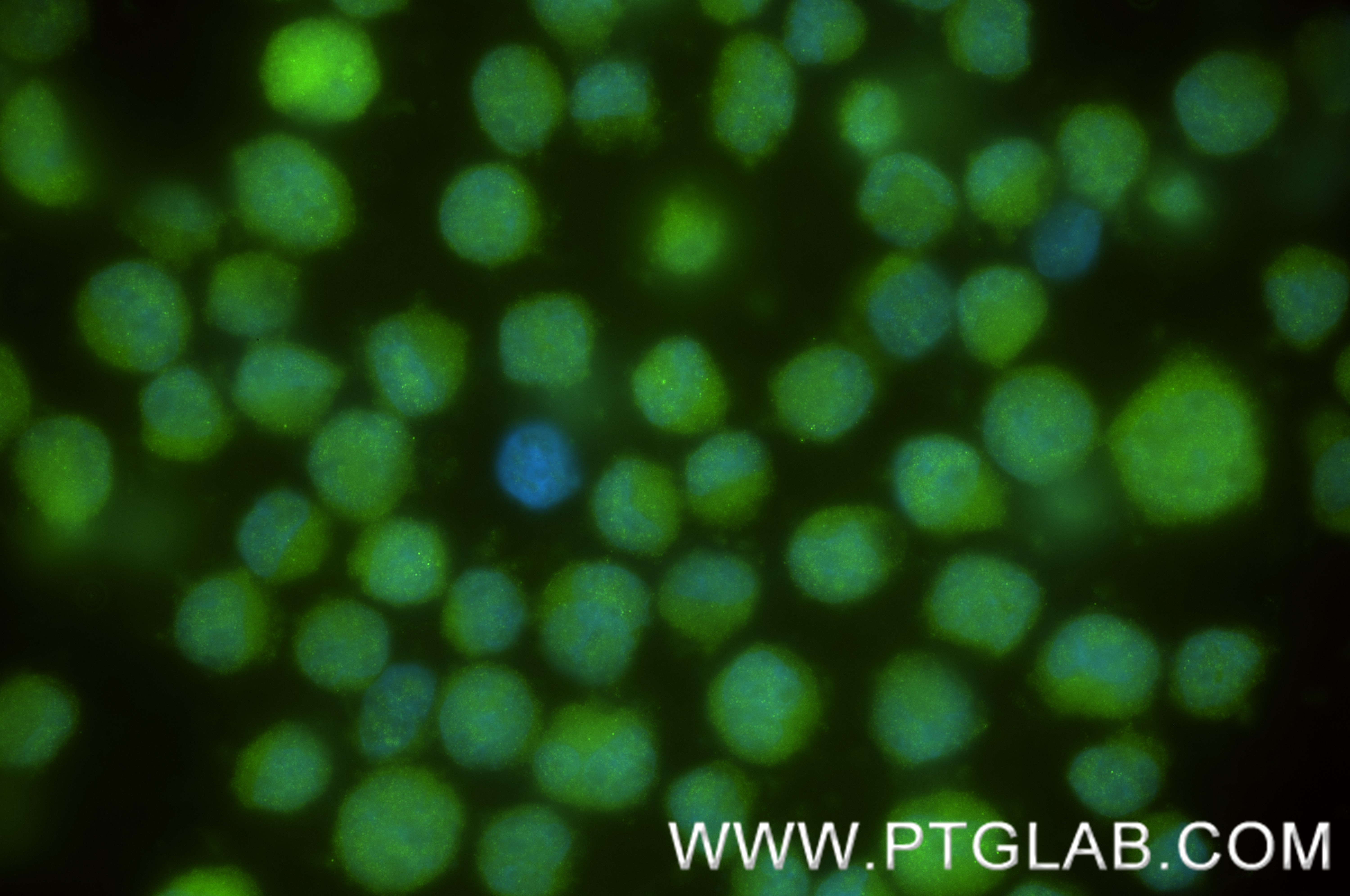 IF Staining of K-562 using 84679-4-RR