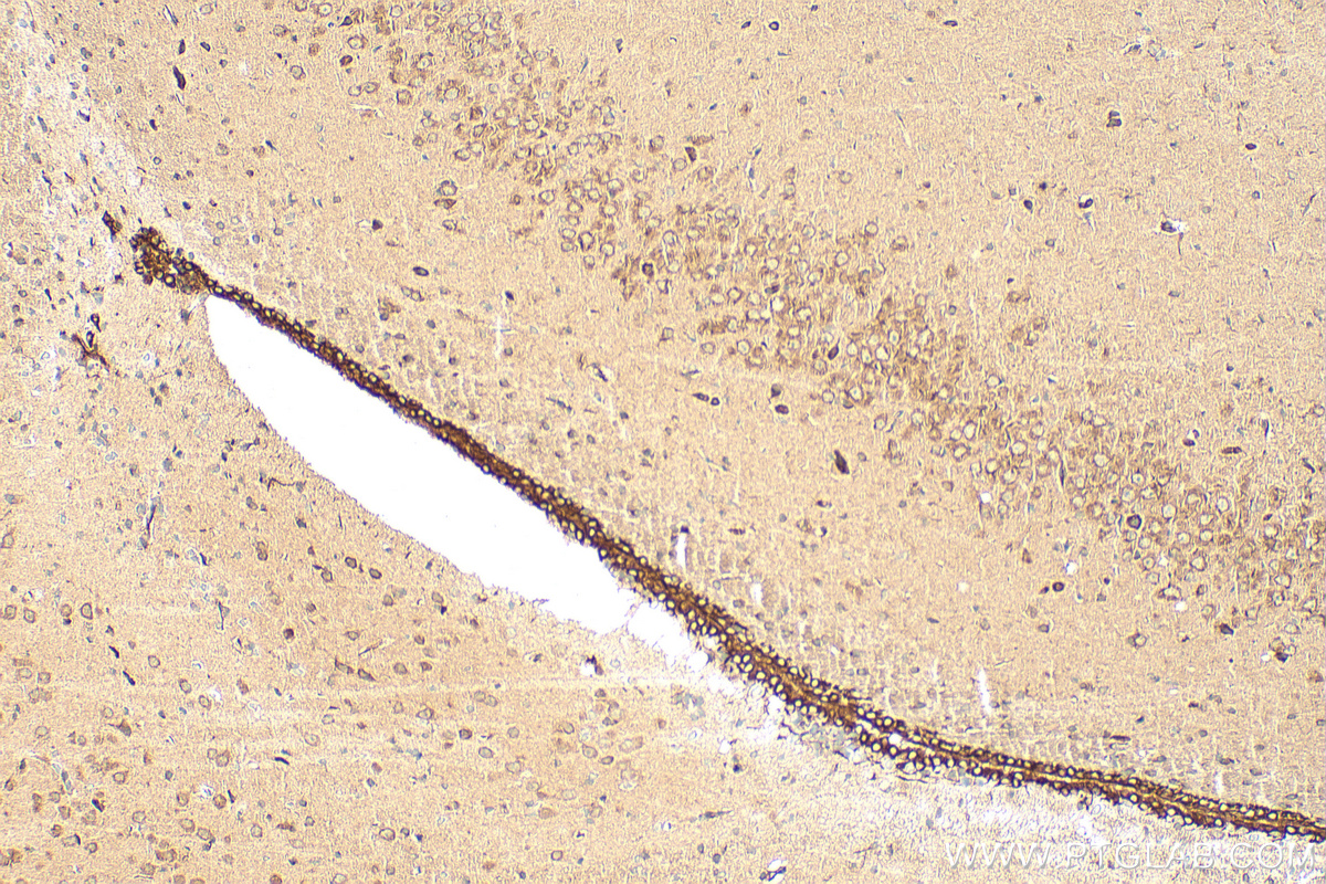 IHC staining of rat brain using 10155-1-AP