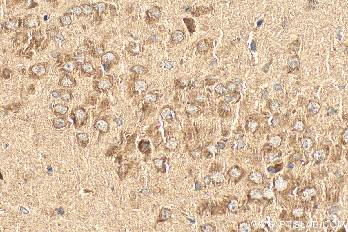 IHC staining of rat brain using 10155-1-AP