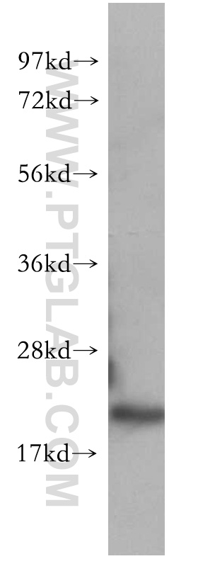 CDC42 Polyclonal antibody