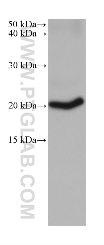 WB analysis of mouse cerebellum using 67212-1-Ig