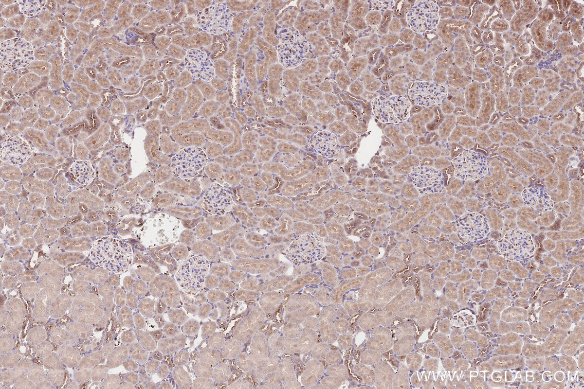IHC staining of rat kidney using 31297-1-AP IHC staining of rat kidney using 31297-1-AP