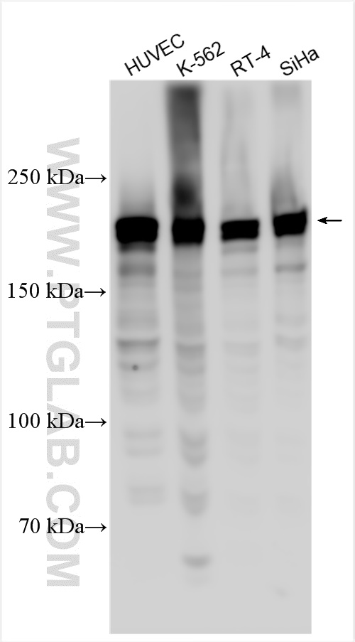 CDC42BPA