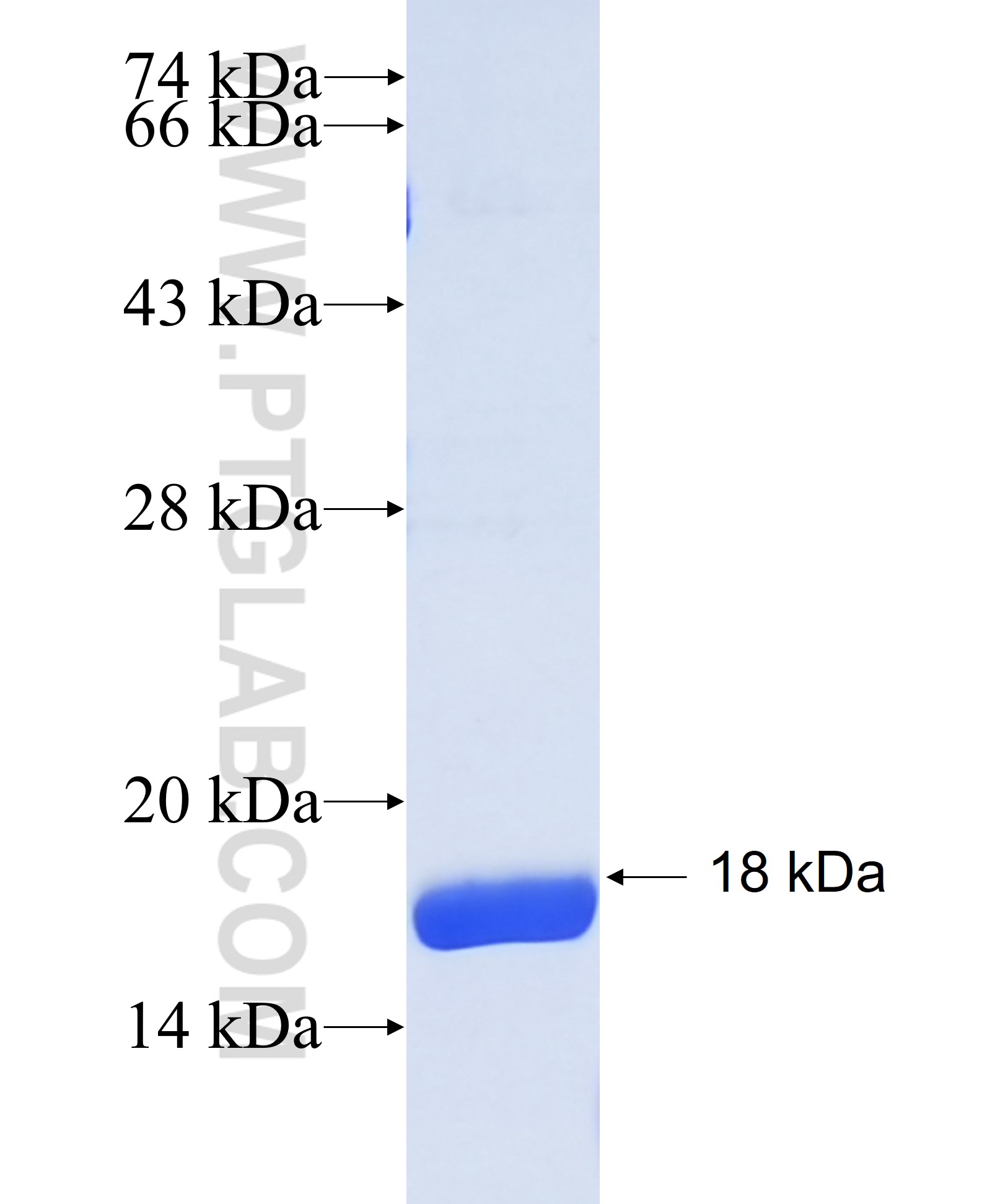CDC42BPA fusion protein Ag34983 SDS-PAGE CDC42BPA fusion protein Ag34983 SDS-PAGE