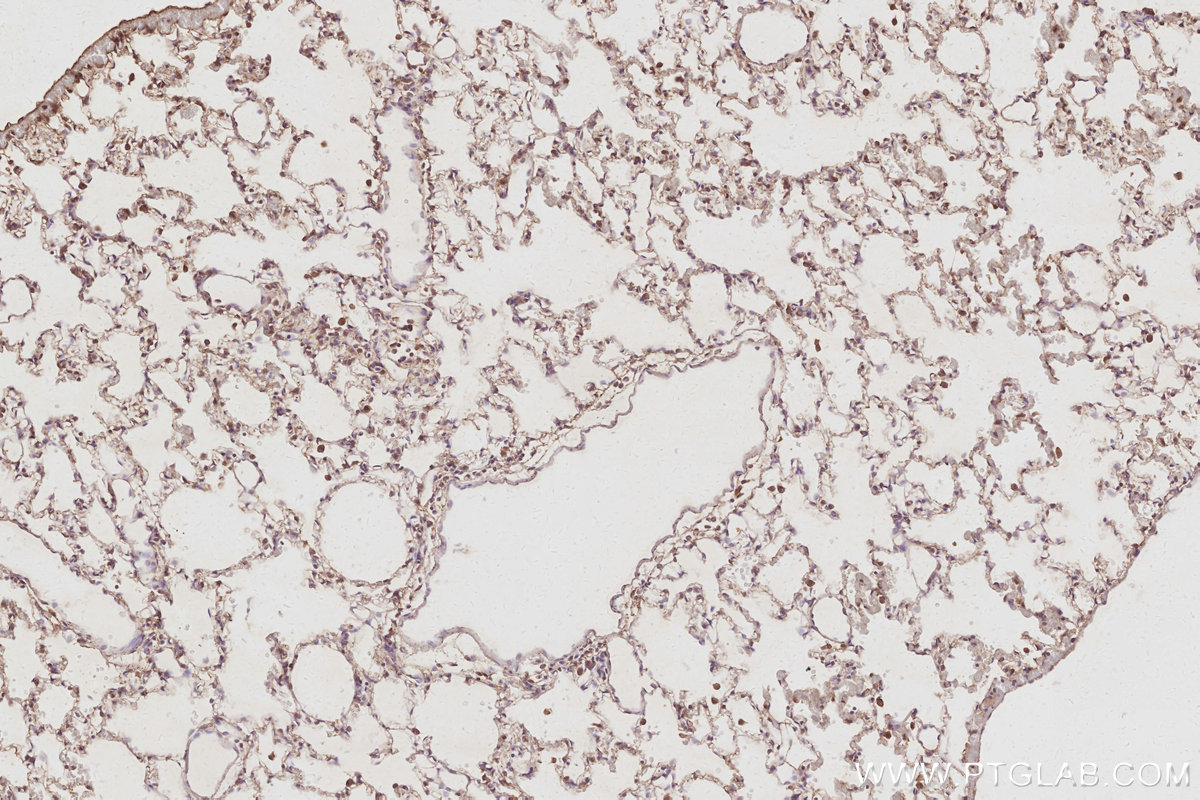 IHC staining of rat lung using 31526-1-AP IHC staining of rat lung using 31526-1-AP