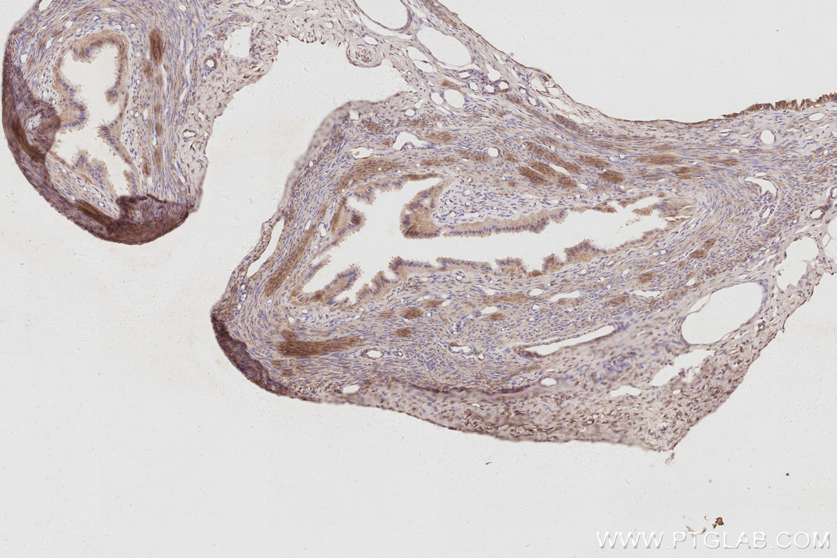 IHC staining of rat ovary using 31526-1-AP IHC staining of rat ovary using 31526-1-AP