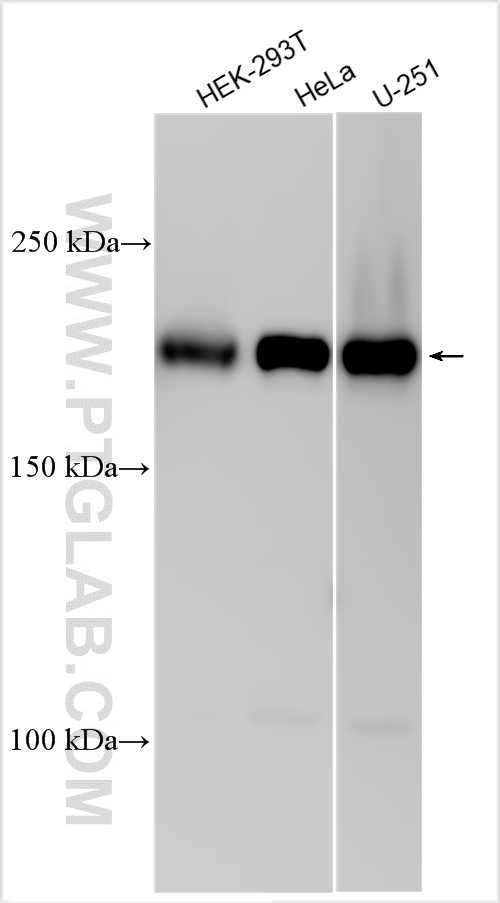 WB analysis using 31526-1-AP