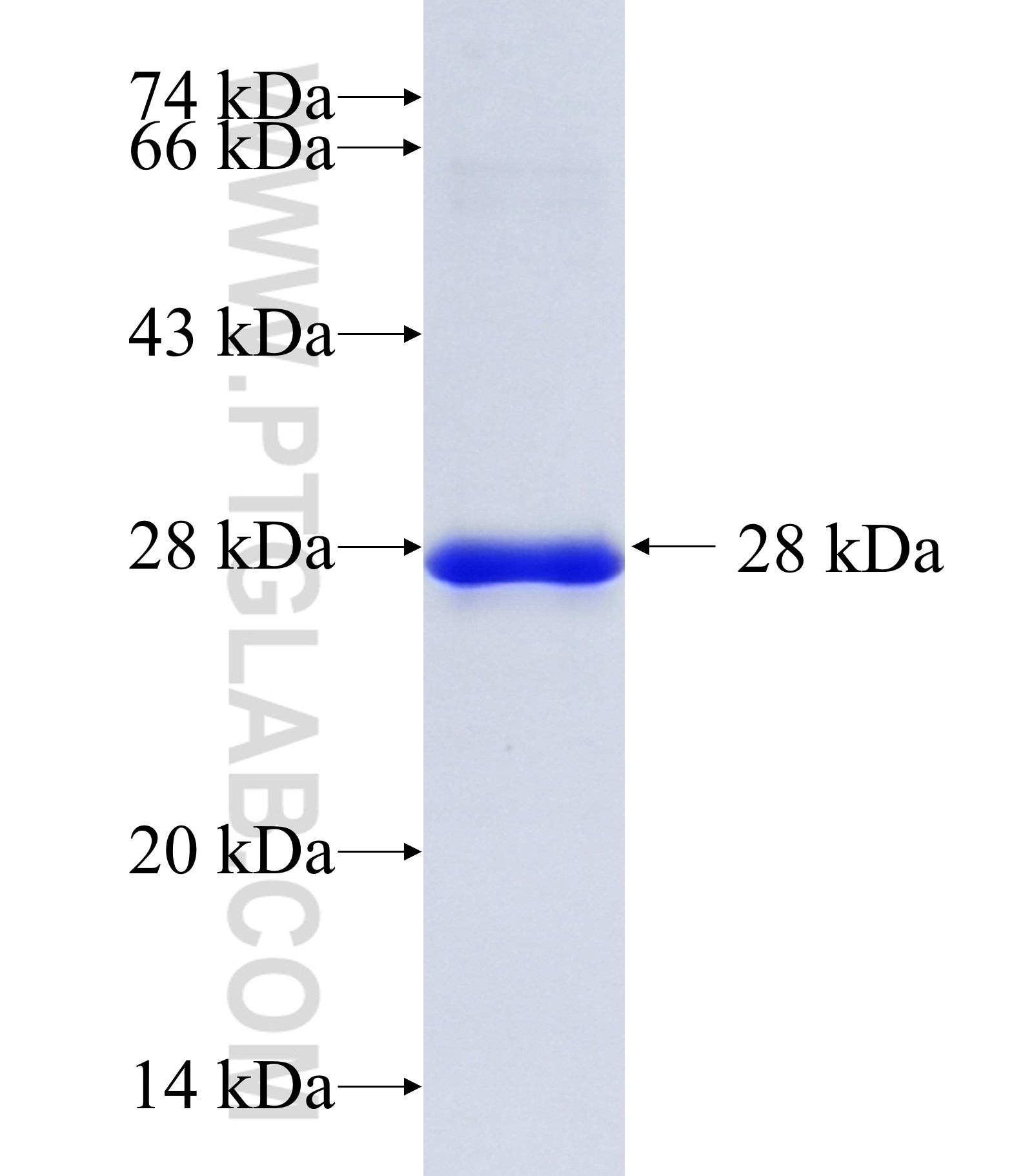 CDC42BPB fusion protein Ag35779 SDS-PAGE CDC42BPB fusion protein Ag35779 SDS-PAGE
