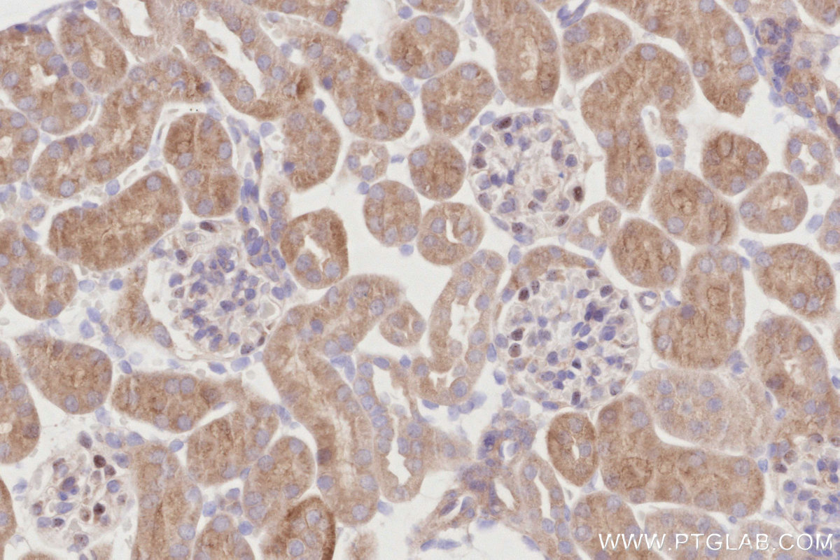 IHC staining of mouse kidney using 19262-1-AP IHC staining of mouse kidney using 19262-1-AP