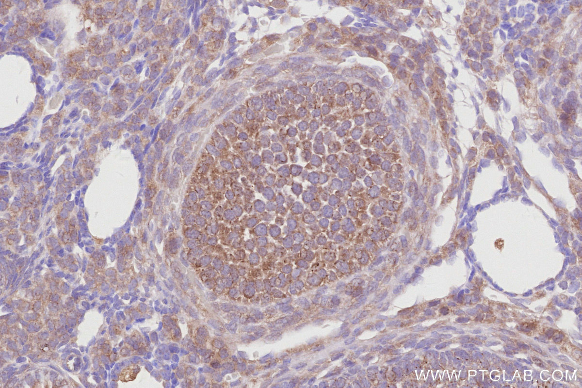 IHC staining of mouse ovary using 19262-1-AP IHC staining of mouse ovary using 19262-1-AP
