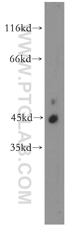 WB analysis of K-562 using 19262-1-AP