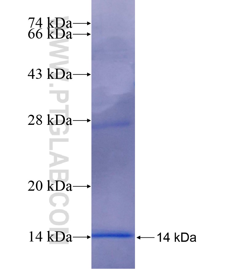 CDC42SE2 fusion protein Ag17015 SDS-PAGE CDC42SE2 fusion protein Ag17015 SDS-PAGE