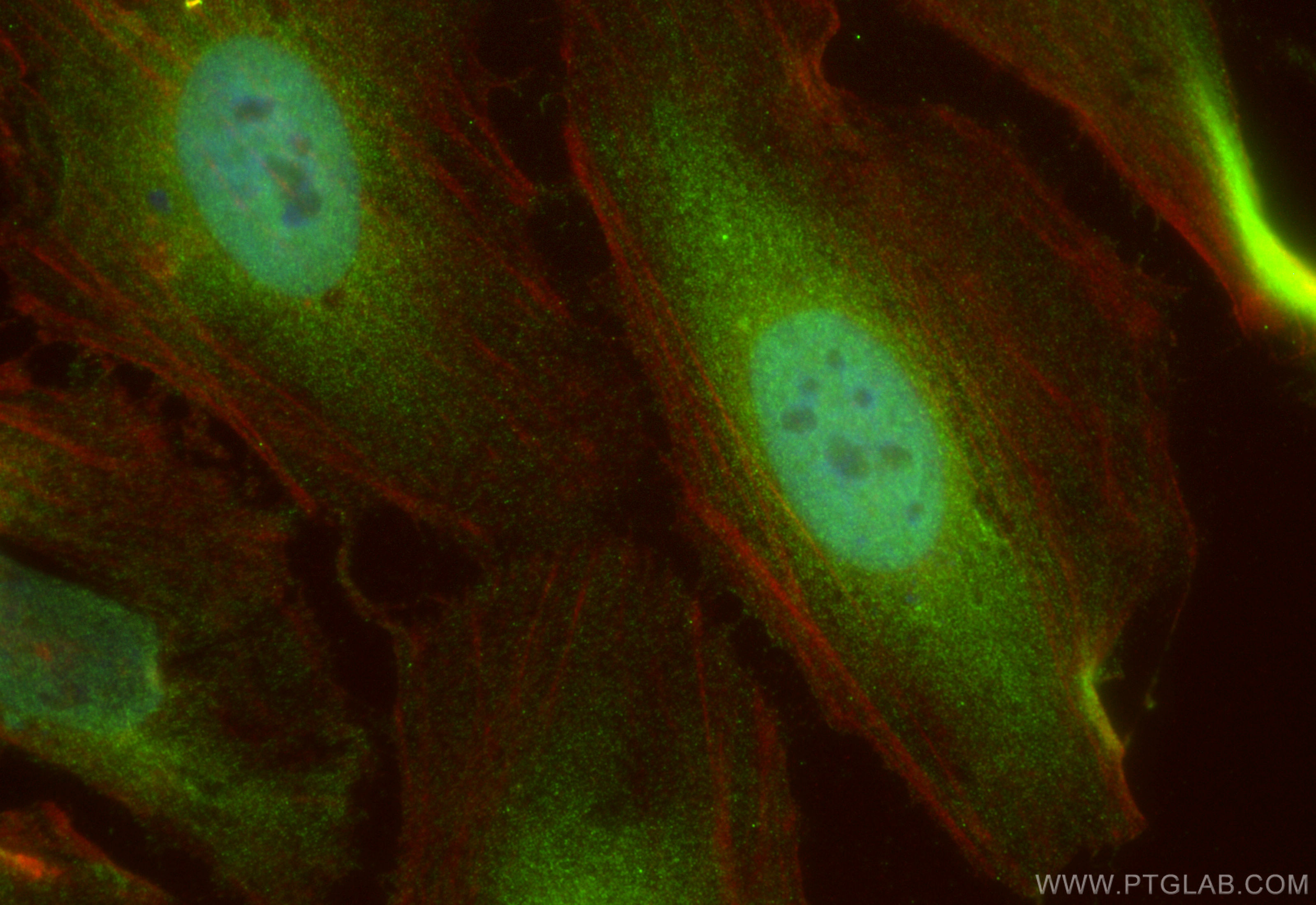 IF Staining of HeLa using 15678-1-AP