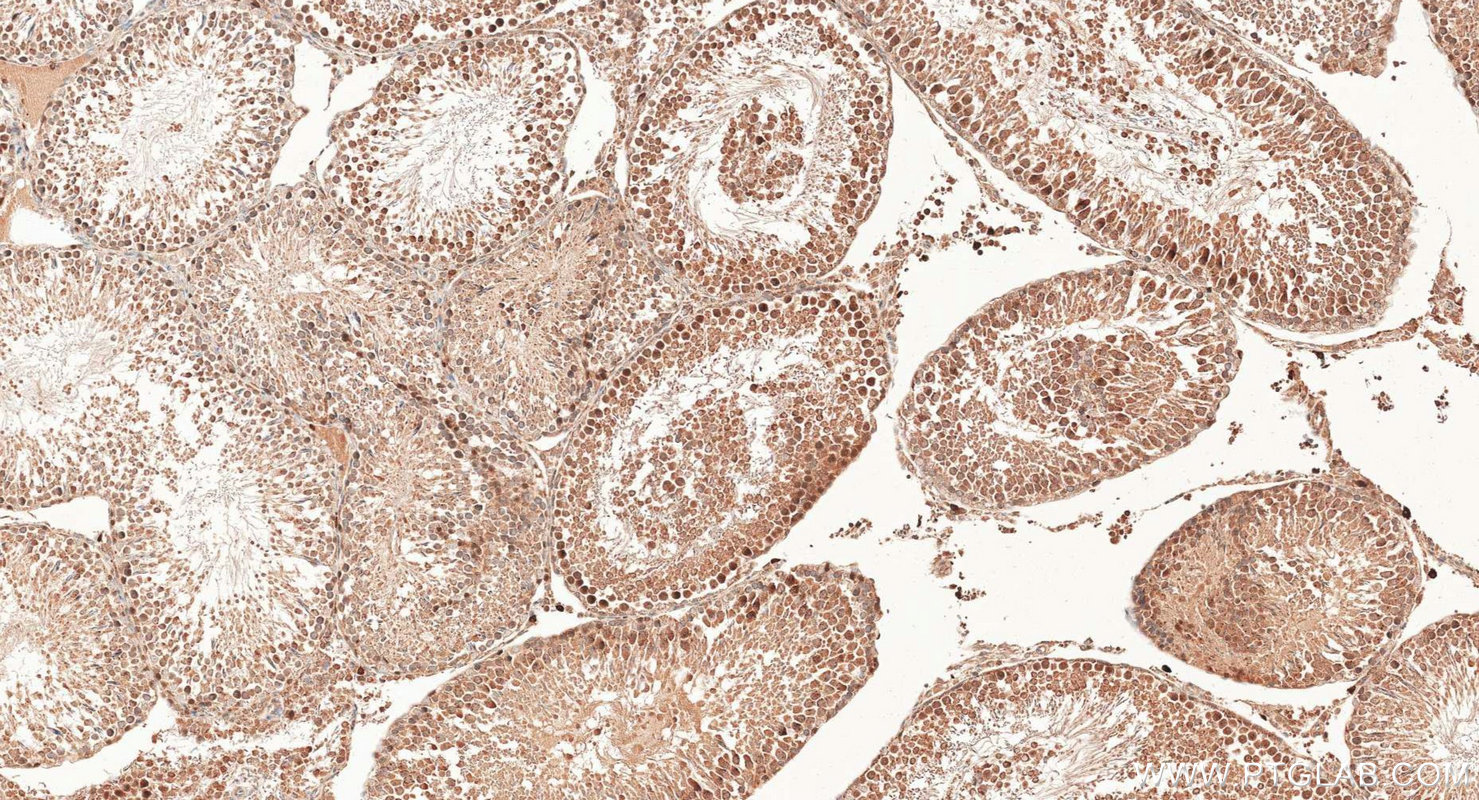 IHC staining of rat testis using 15678-1-AP IHC staining of rat testis using 15678-1-AP