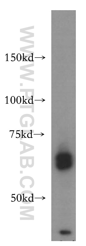 WB analysis of K-562 using 15678-1-AP