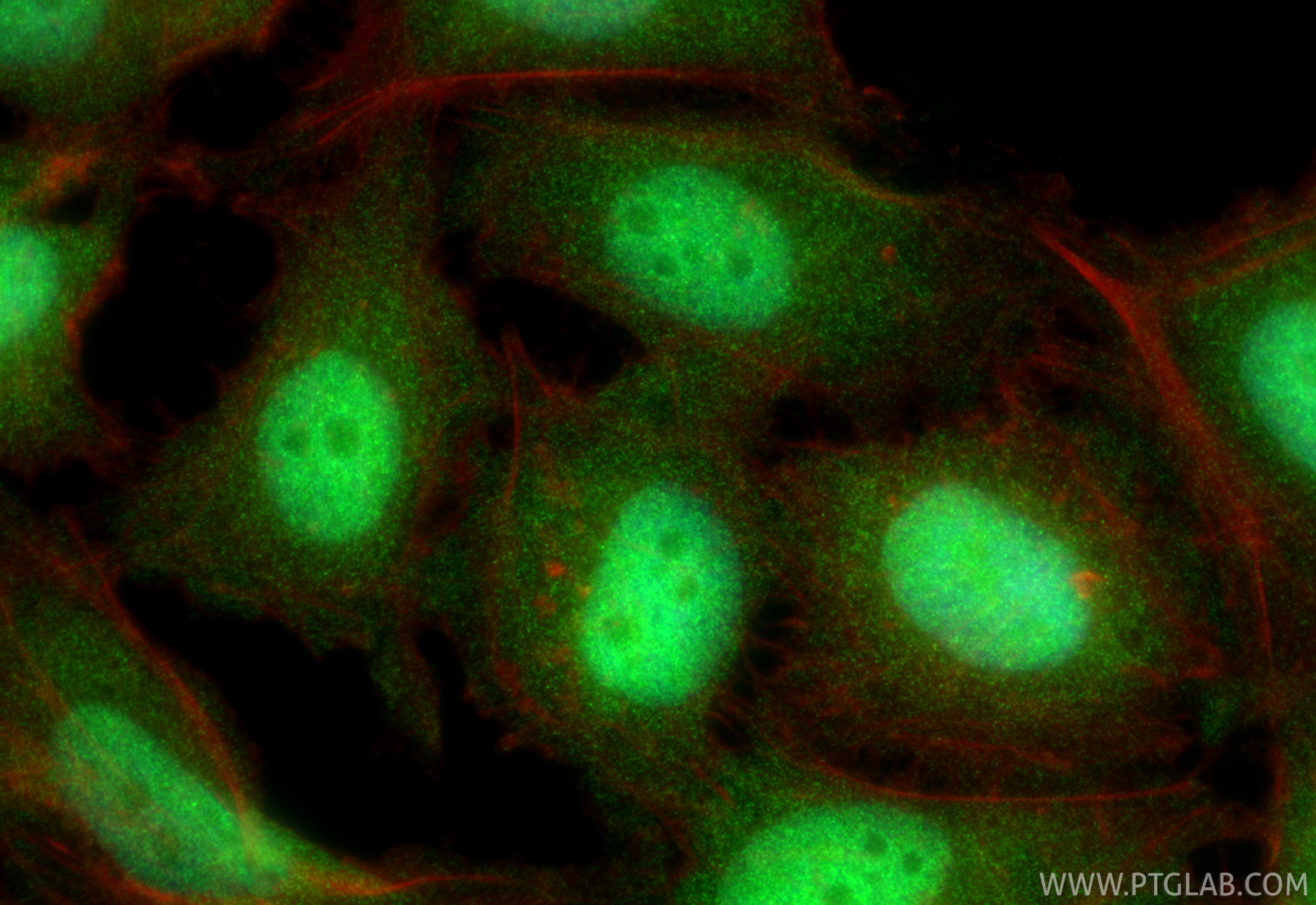IF Staining of HeLa using 87219-1-RR IF Staining of HeLa using 87219-1-RR