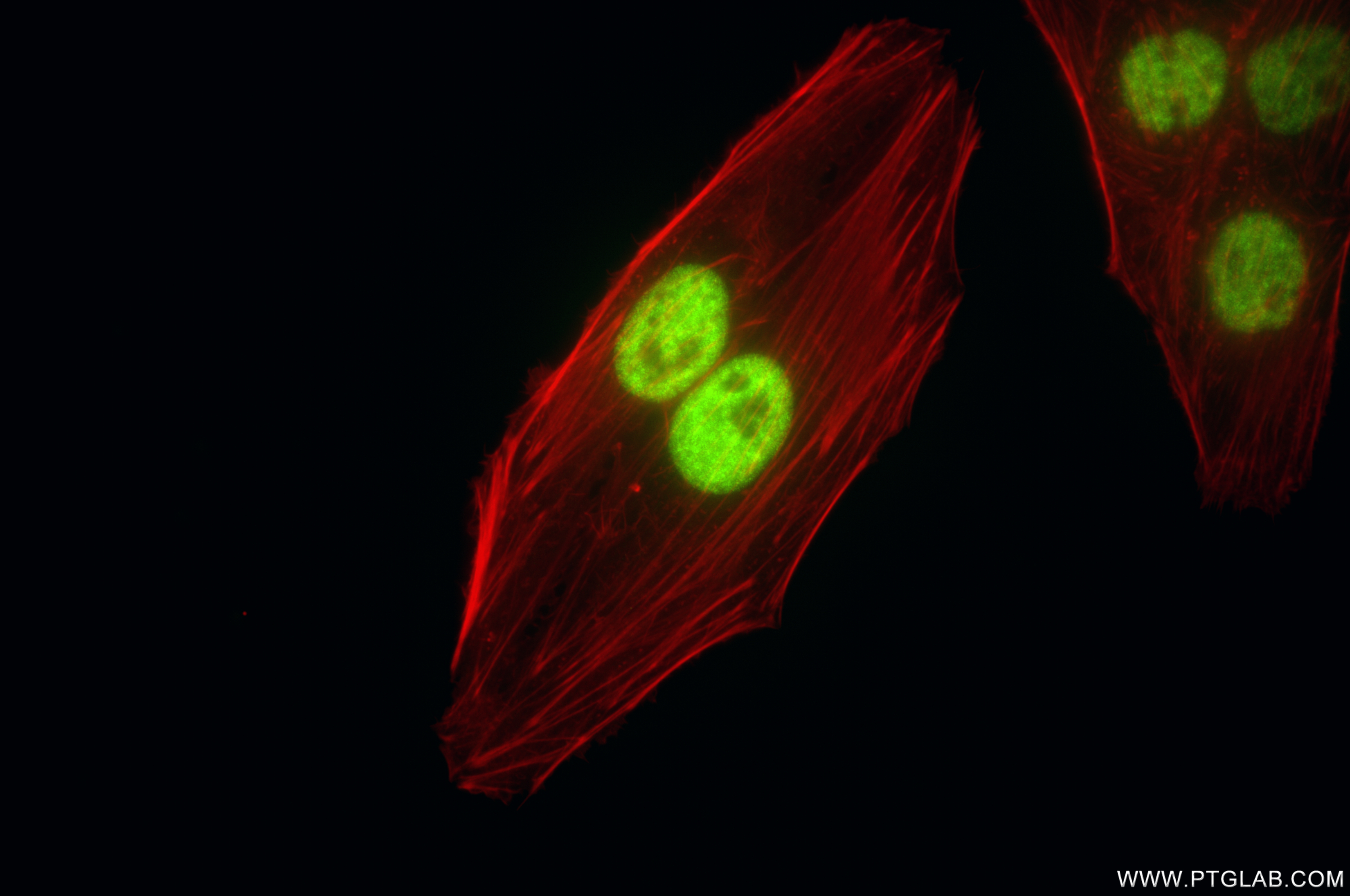 IF Staining of HepG2 using 85788-5-RR (same clone as 85788-5-PBS)