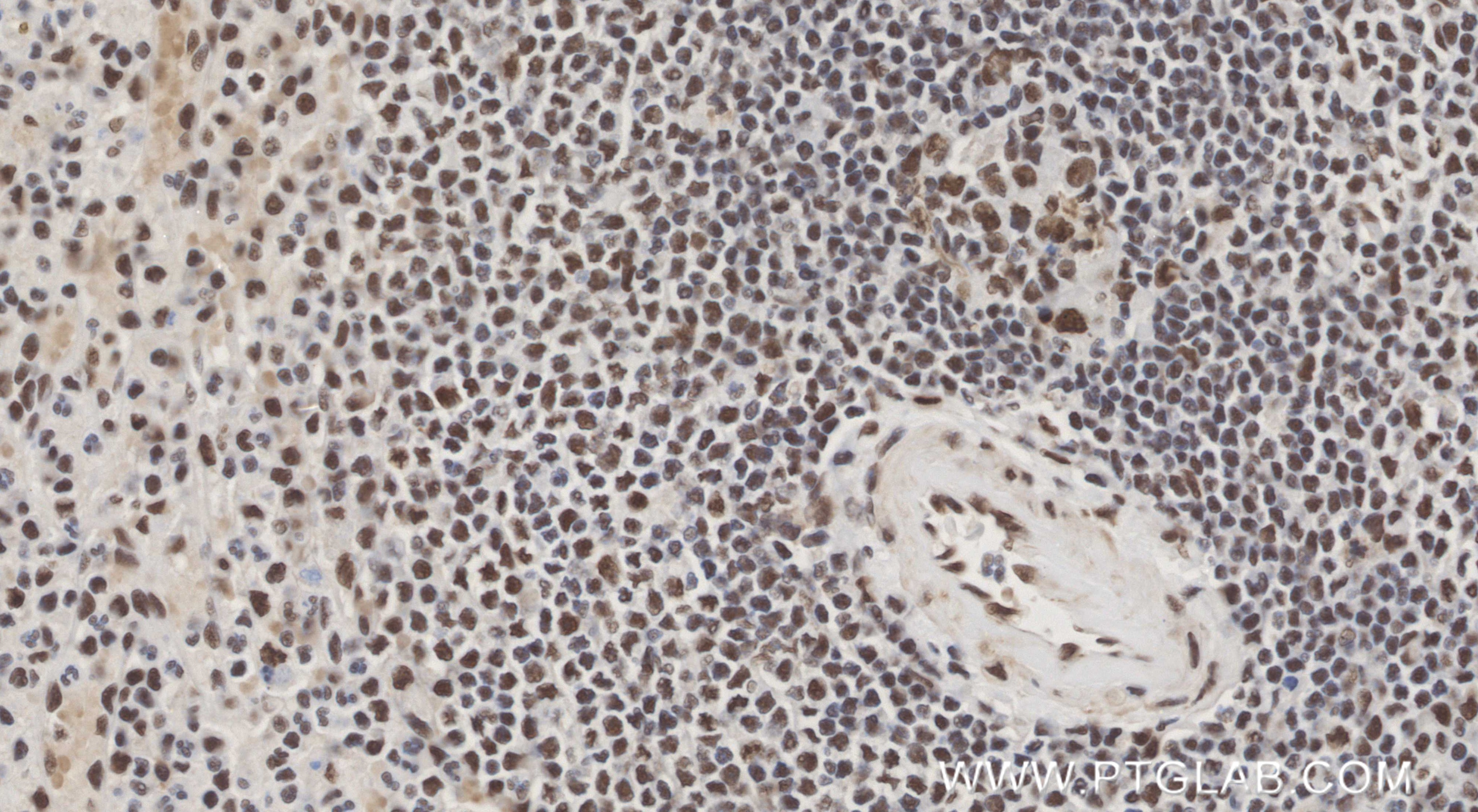 IHC staining of human spleen using 85788-5-RR