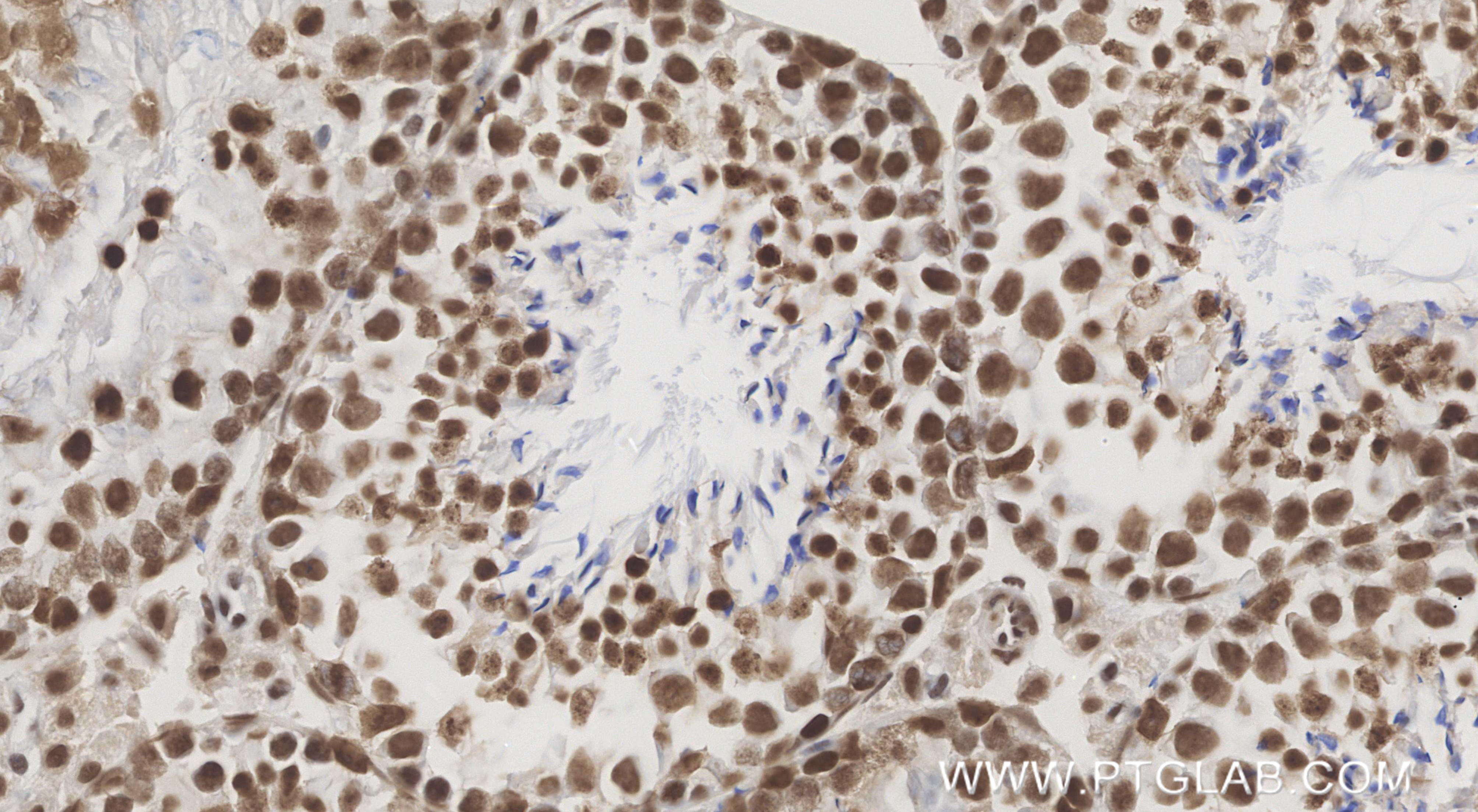 IHC staining of mouse testis using 85788-5-RR