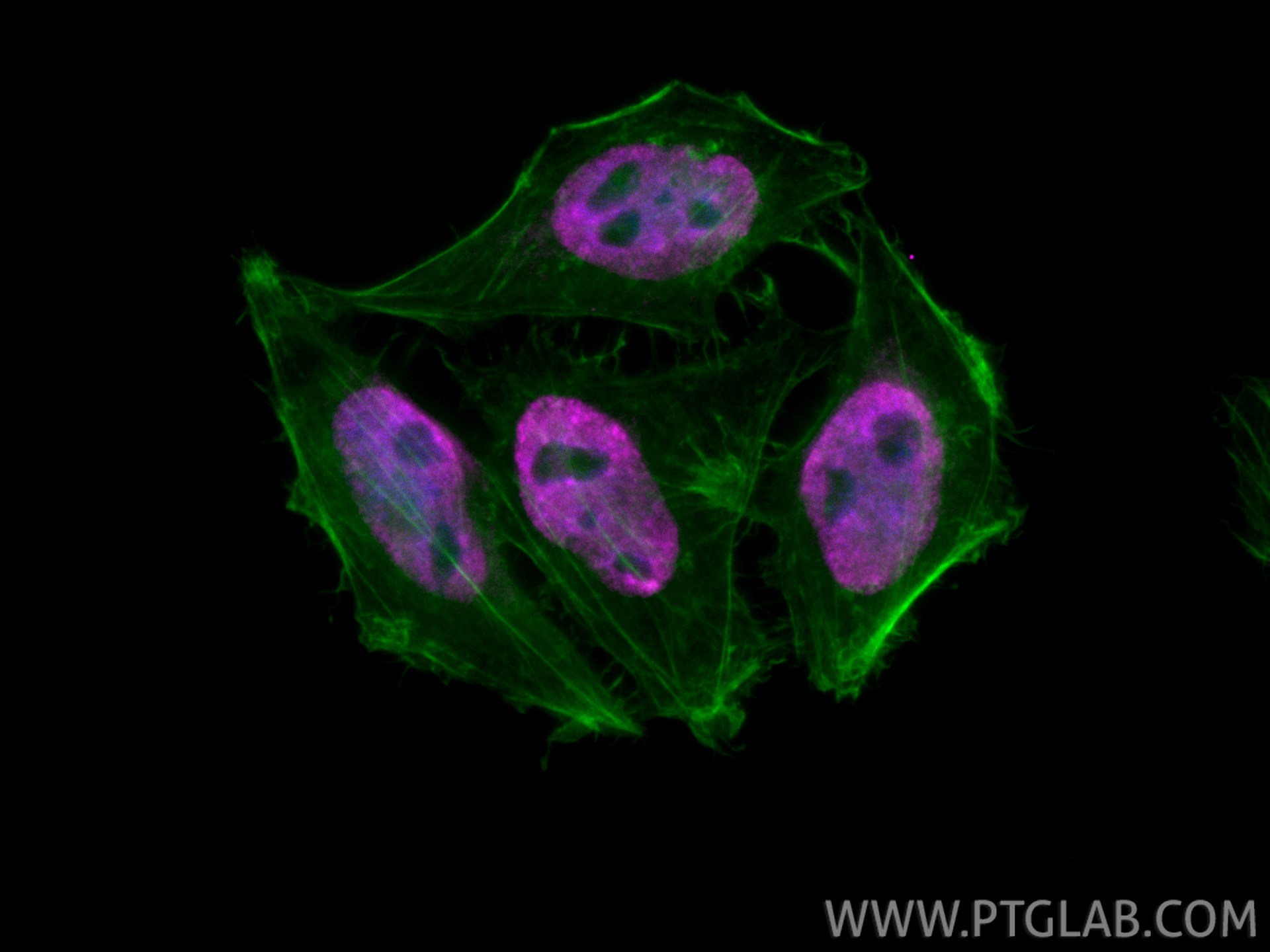 IF Staining of HepG2 using CL647-85788-5