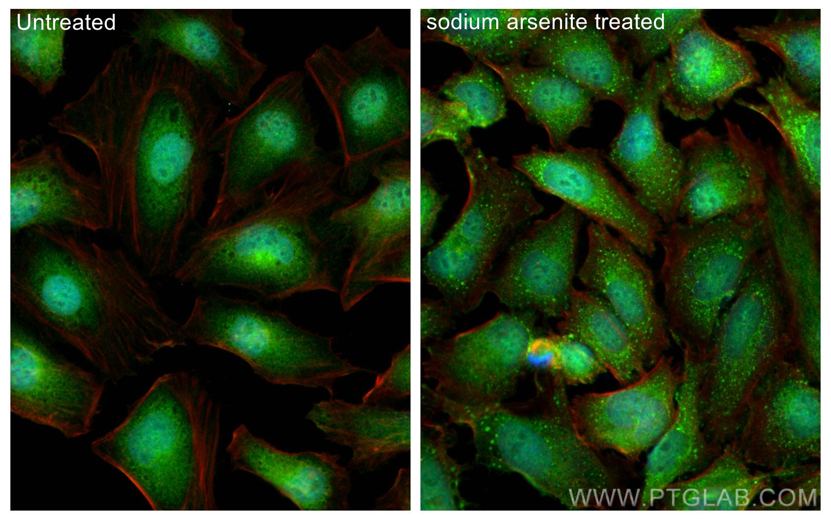 IF Staining of HeLa using 11640-1-AP