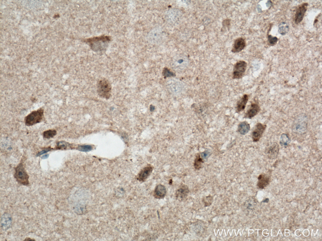 IHC staining of mouse brain using 11640-1-AP