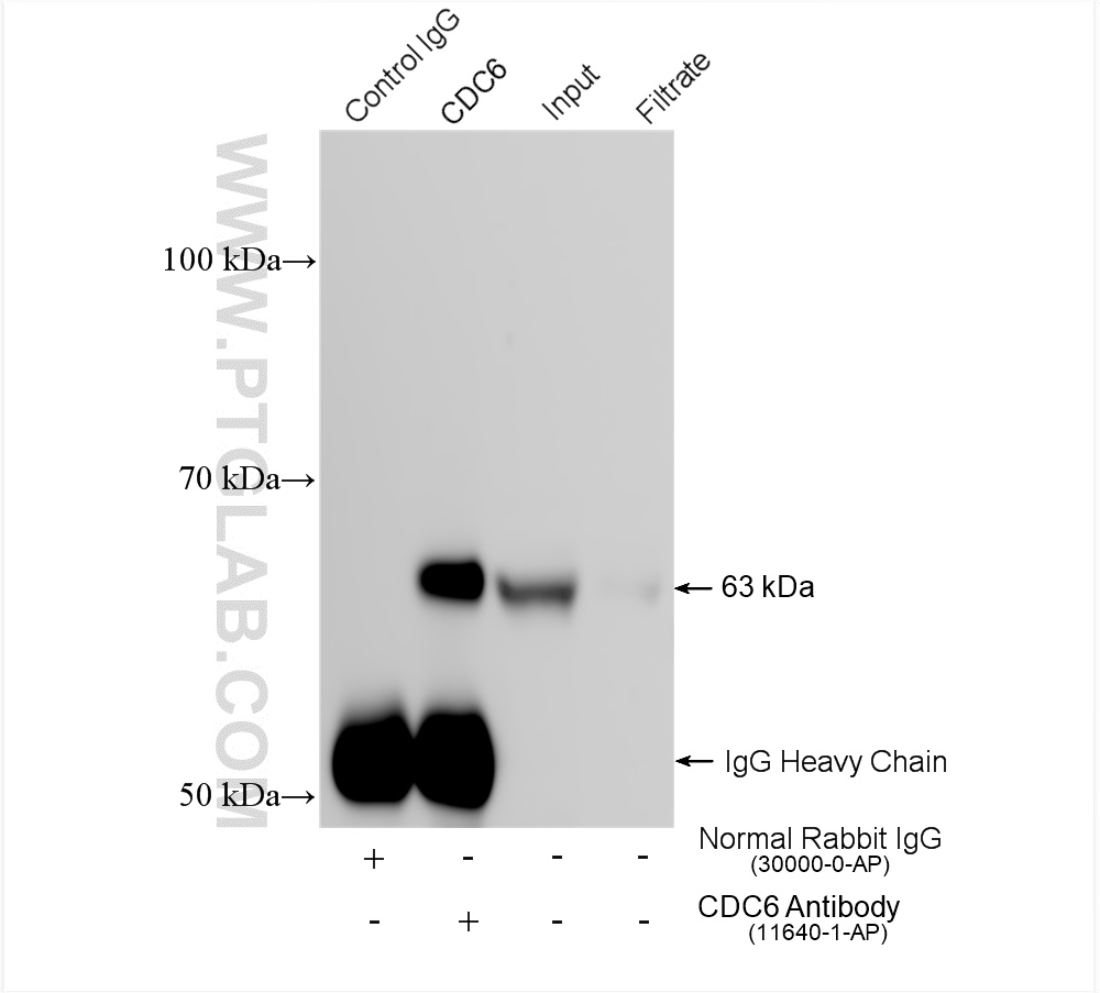 IP experiment of HeLa using 11640-1-AP