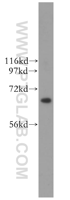 CDC6 Polyclonal antibody