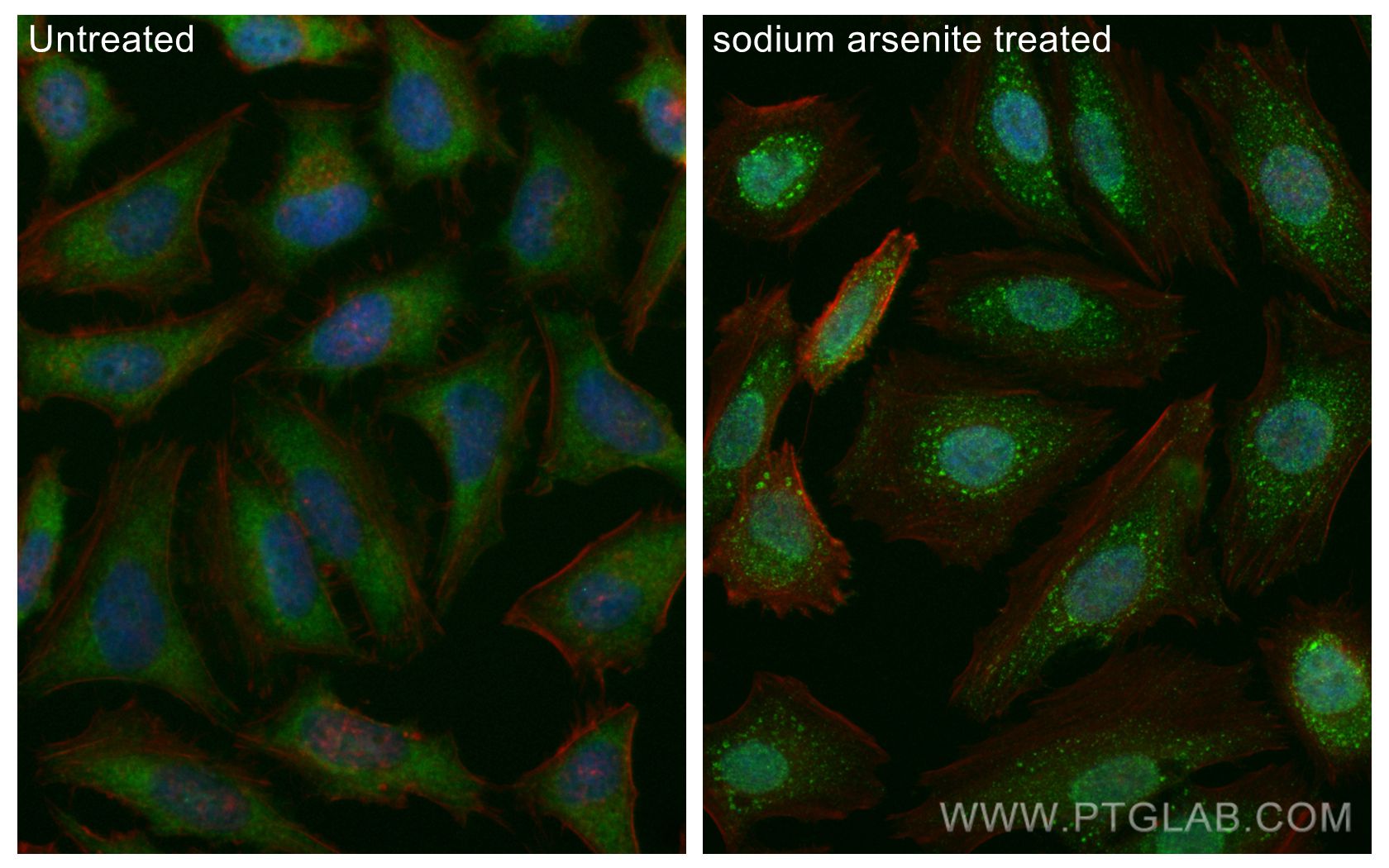 IF Staining of HeLa using 66021-1-Ig