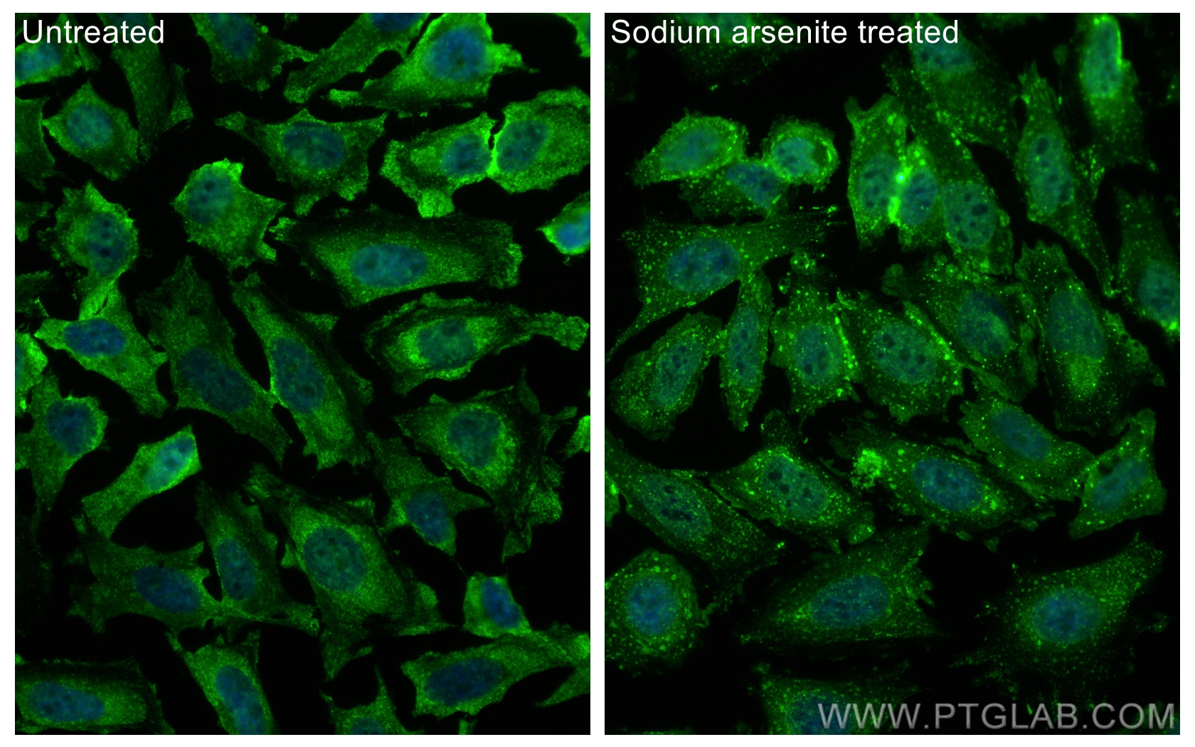 IF Staining of HeLa using CL488-66021