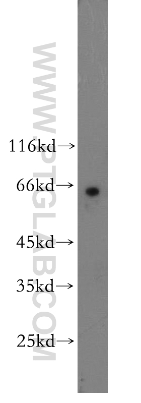 WB analysis of SH-SY5Y using 17980-1-AP