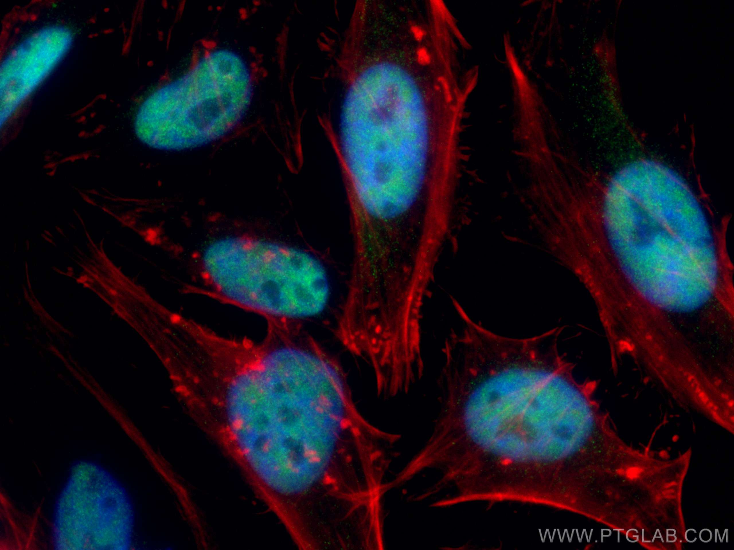 IF Staining of HeLa using 12310-1-AP