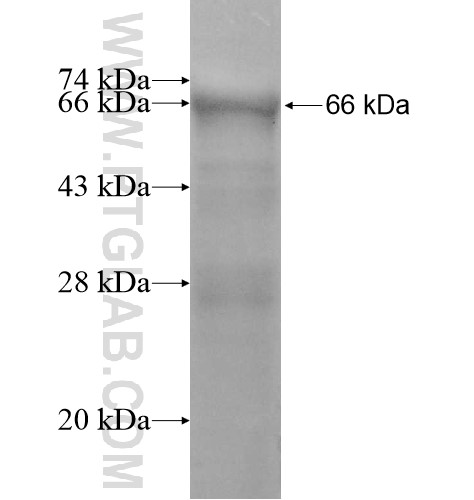CDCA2 fusion protein Ag11967 SDS-PAGE
