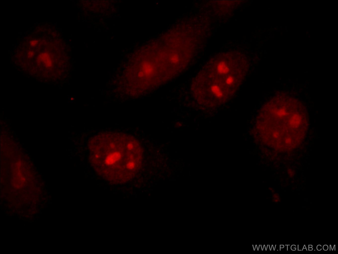 IF Staining of HepG2 using 15249-1-AP