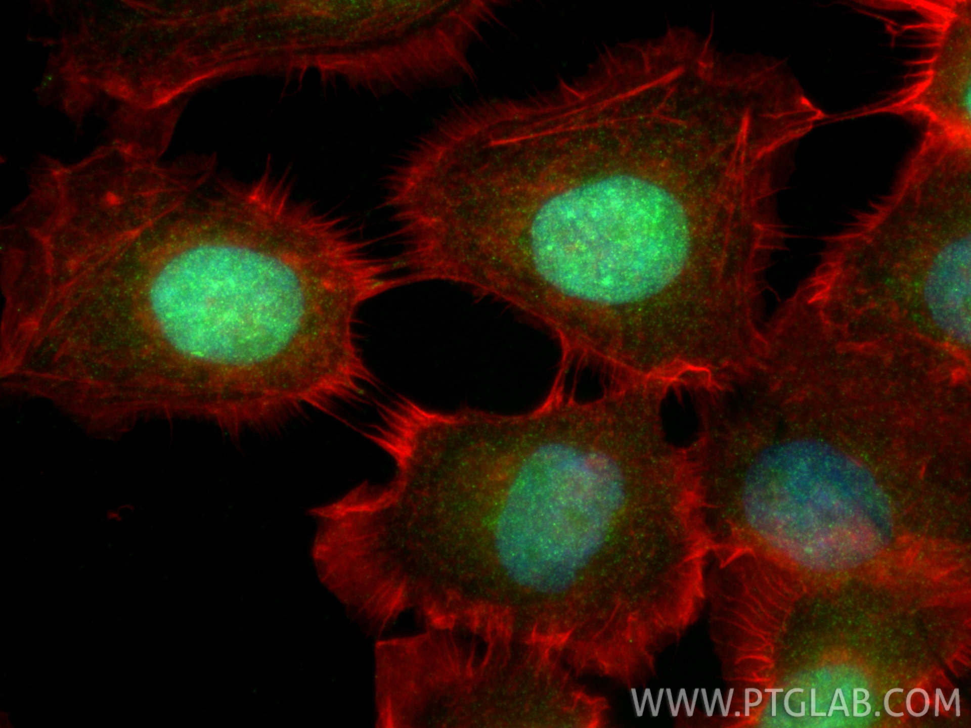 IF Staining of A431 using 12465-1-AP