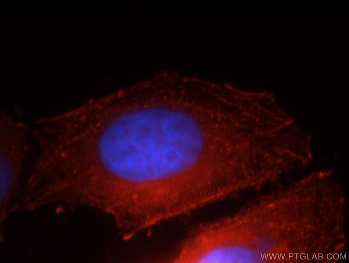 IF Staining of HepG2 using 20648-1-AP