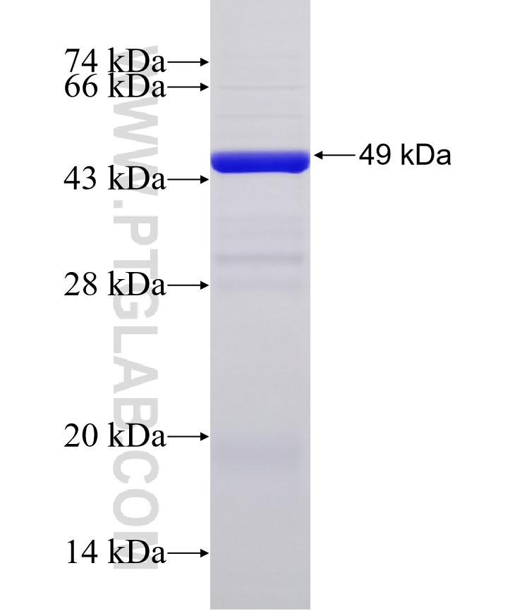 CDH12 fusion protein Ag32954 SDS-PAGE CDH12 fusion protein Ag32954 SDS-PAGE