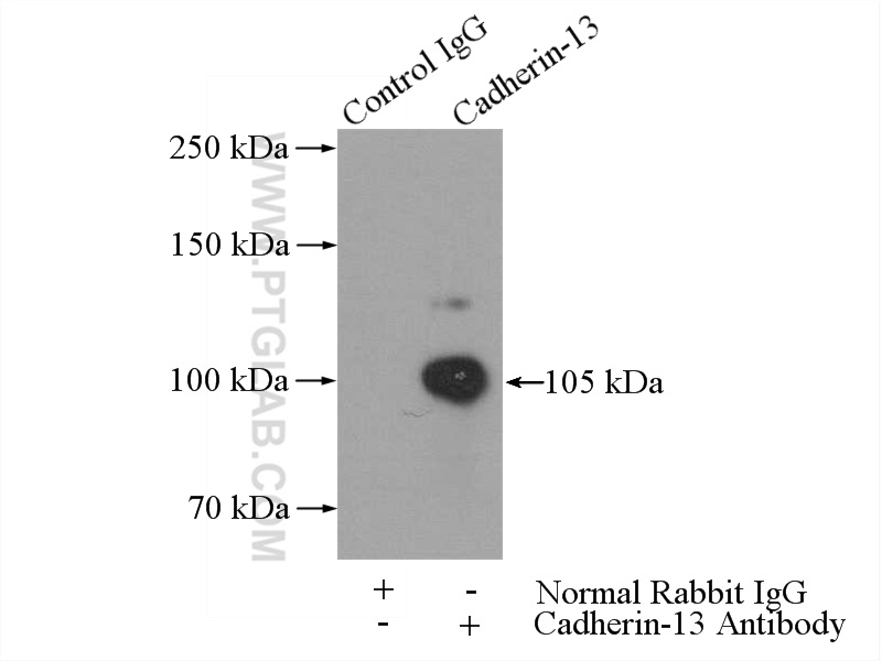 IP experiment of mouse heart using 12618-1-AP