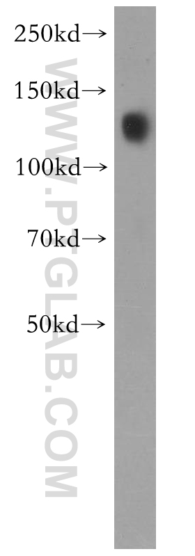 Cadherin-16 Polyclonal antibody