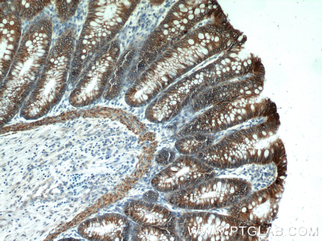 IHC staining of human colon using 24339-1-AP