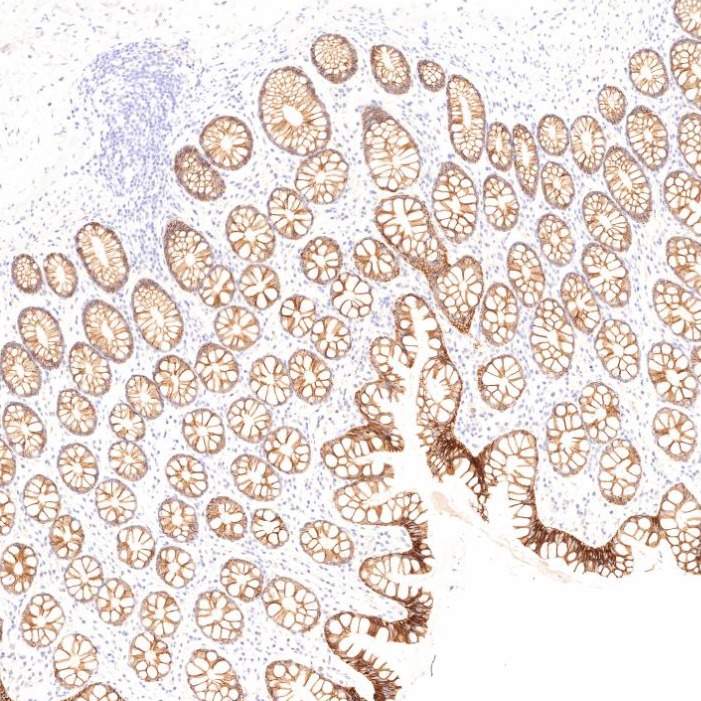 IHC staining of human large intestine using 60351-1-Ig