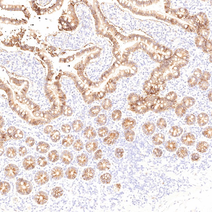 IHC staining of human small intestine using 60351-1-Ig
