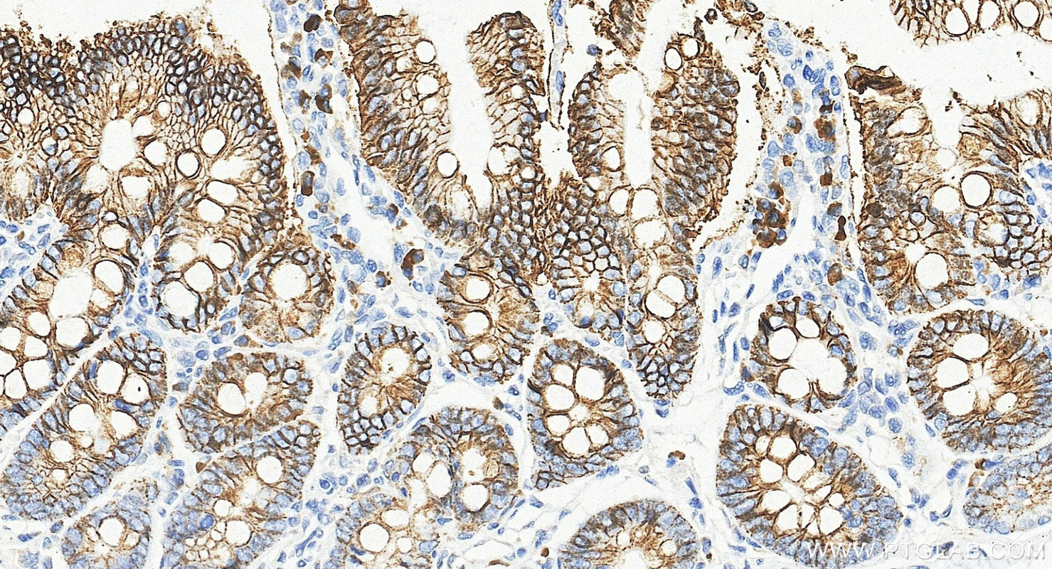 IHC staining of rat small intestine using 60351-1-Ig